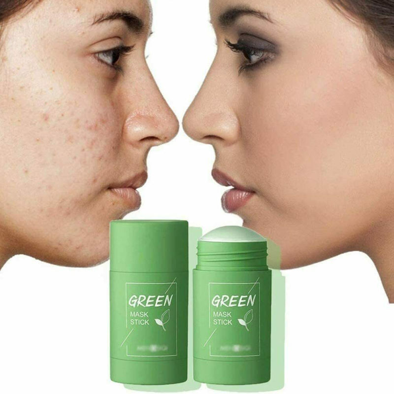 Зелёная маска от прыщей Green Acne Stick. Вид 3 Зелёная маска от прыщей Green Acne Stick. Вид 3